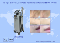 सभी प्रकार की त्वचा दर्द रहित 1064 755 808nm डायोडर लेजर बाल हटाने की मशीन