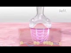 MLS05 पोर्टेबल 40K कैविटेशन वैक्यूम आरएफ अल्ट्रासोनिक सेल्युलाईट रिड्यूस डिवाइस