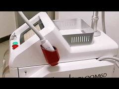 FD08 फाइबर युग्मित 808nm डायोड लेजर कपलिंग बाल हटाने की मशीन