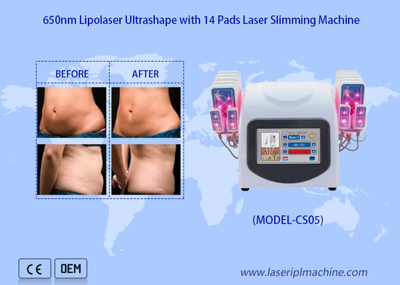 सेल्युलाईट फैट हटाने को कम करने के लिए 650nm लिपो लेजर पैड लेजर लिपोसक्शन मशीन