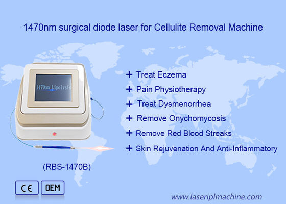 अच्छी कीमत 1470nm 980nm डायोड लेजर लिपोलिसिस सर्जरी लेजर डिवाइस वसा घुलनशील ऑनलाइन