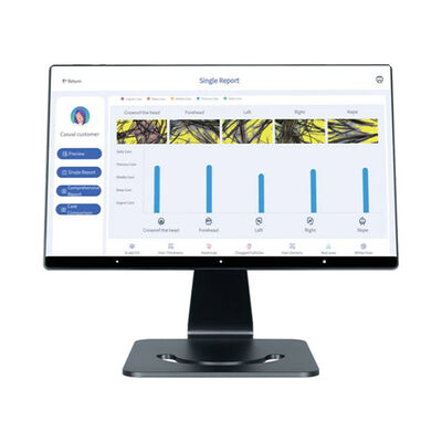 4 भाषाएं स्मार्ट अल स्कैल्प एनालाइजर हेयर स्कैल्प केयर टारगेटेड हेड मशीन